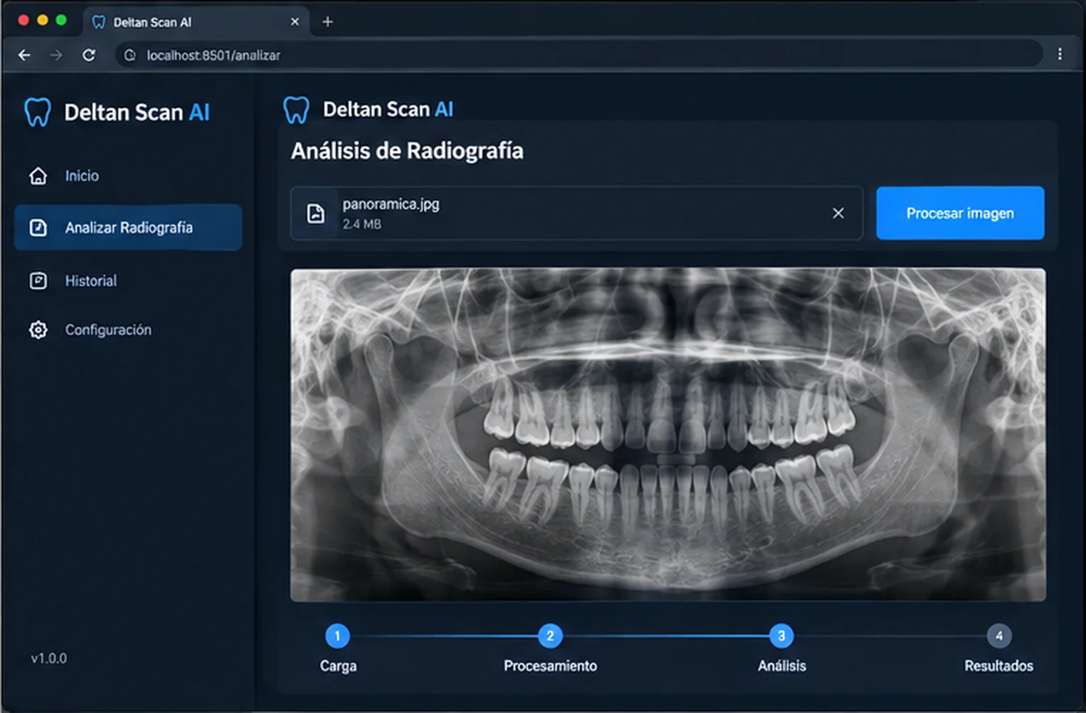 La radiografía cargada, lista para procesar. El flujo va guiado en cuatro pasos.